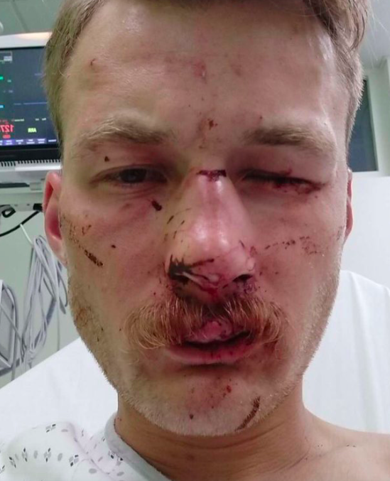 Bordeaux : un candidat RN aux législatives passé à tabac par « trente à quarante » antifas
