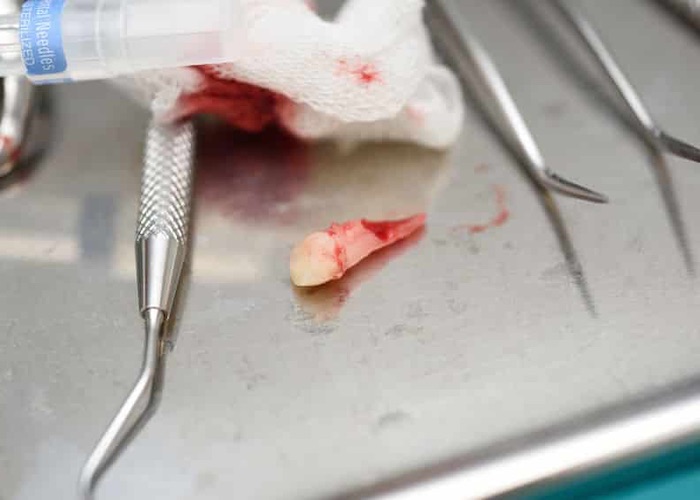 Mutilations dentaires : huit ans de prison ferme contre le dentiste Lionel Guedj